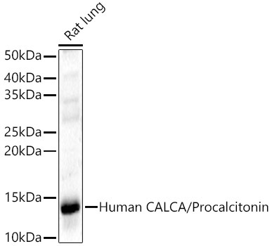 CALCA Rabbit Polyclonal Antibody