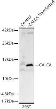 CALCA Rabbit Polyclonal Antibody - Image 2