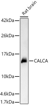 CALCA Rabbit Polyclonal Antibody - Image 3