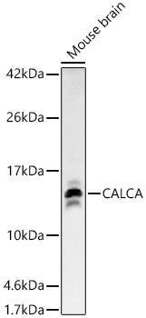 CALCA Rabbit Polyclonal Antibody - Image 4