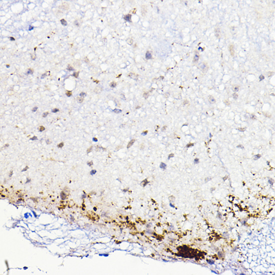 CALCA Rabbit Polyclonal Antibody