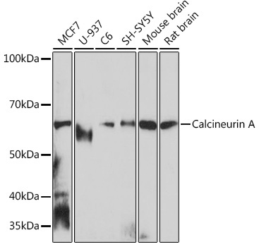 Calcineurin A Rabbit Monoclonal Antibody