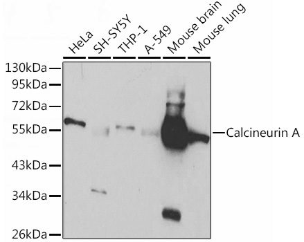 Calcineurin A Rabbit Polyclonal Antibody