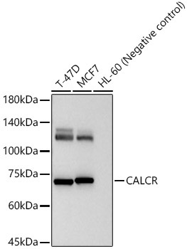 CALCR Rabbit Polyclonal Antibody