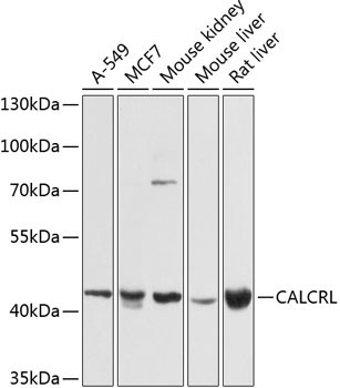 CALCRL Rabbit Polyclonal Antibody