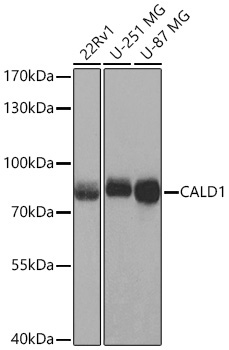 CALD1 Rabbit Polyclonal Antibody - Image 2