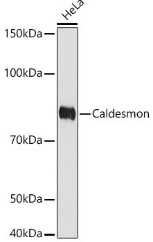 Caldesmon Rabbit Monoclonal Antibody