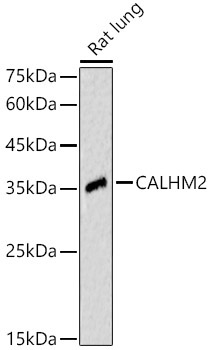 CALHM2 Rabbit Polyclonal Antibody