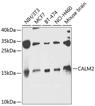 CALM2 Rabbit Polyclonal Antibody