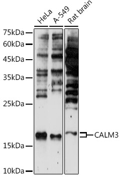 CALM3 Rabbit Polyclonal Antibody