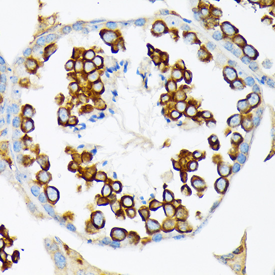 Calmegin Rabbit Monoclonal Antibody - Image 3