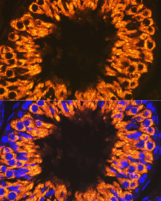 Calmegin Rabbit Monoclonal Antibody - Image 5
