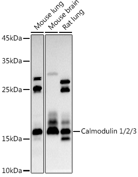 Calmodulin 1/2/3 Rabbit Polyclonal Antibody