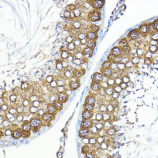 Calmodulin 1/2/3 Rabbit Polyclonal Antibody