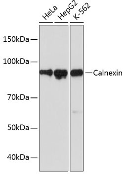 Calnexin Rabbit Monoclonal Antibody