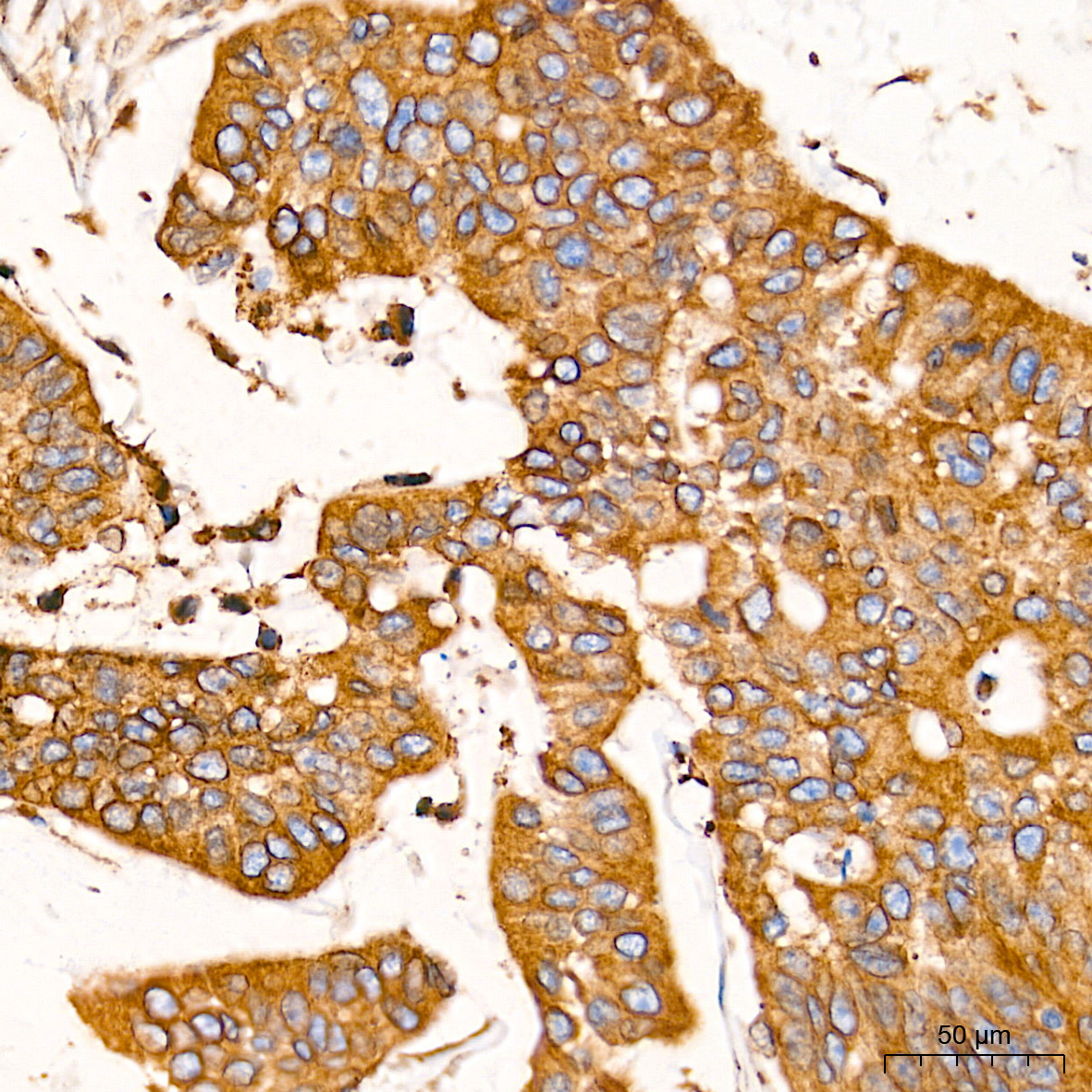 Calnexin Rabbit Polyclonal Antibody - Image 2