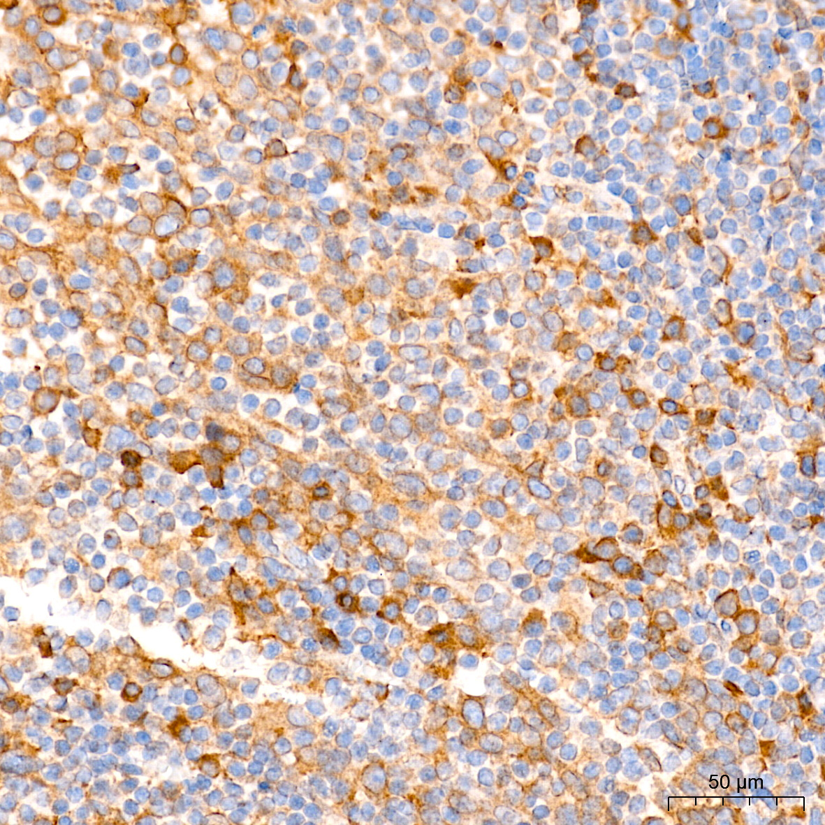 Calnexin Rabbit Polyclonal Antibody - Image 4