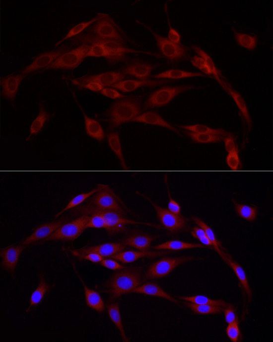 Calnexin Rabbit Polyclonal Antibody - Image 5