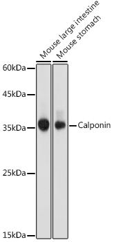 Calponin Rabbit Polyclonal Antibody