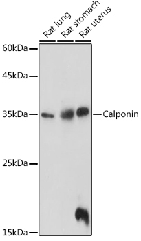 Calponin Rabbit Polyclonal Antibody - Image 2