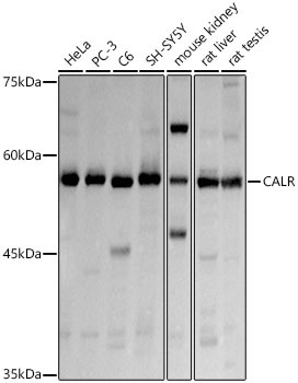 Calreticulin Rabbit Polyclonal Antibody
