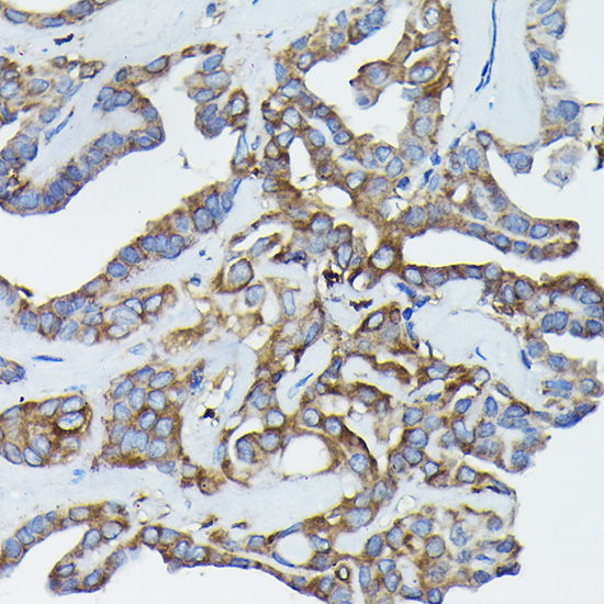Calreticulin Rabbit Polyclonal Antibody - Image 2