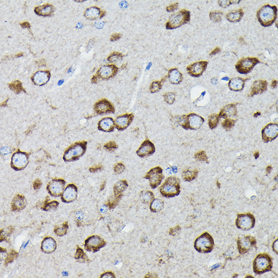 Calreticulin Rabbit Polyclonal Antibody - Image 3