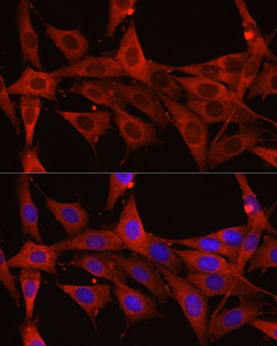 Calreticulin Rabbit Polyclonal Antibody - Image 4