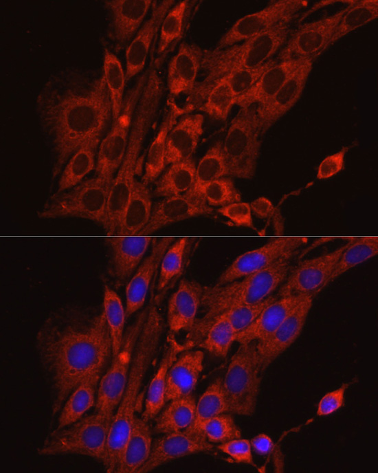 Calreticulin Rabbit Polyclonal Antibody - Image 5