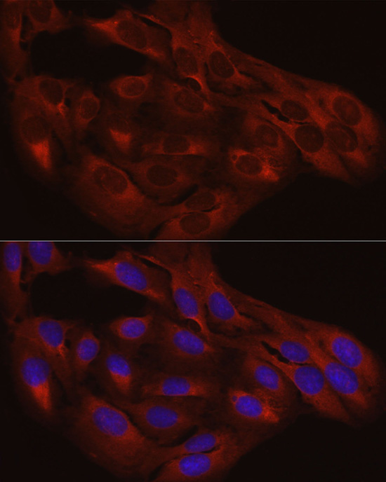 Calreticulin Rabbit Polyclonal Antibody - Image 6