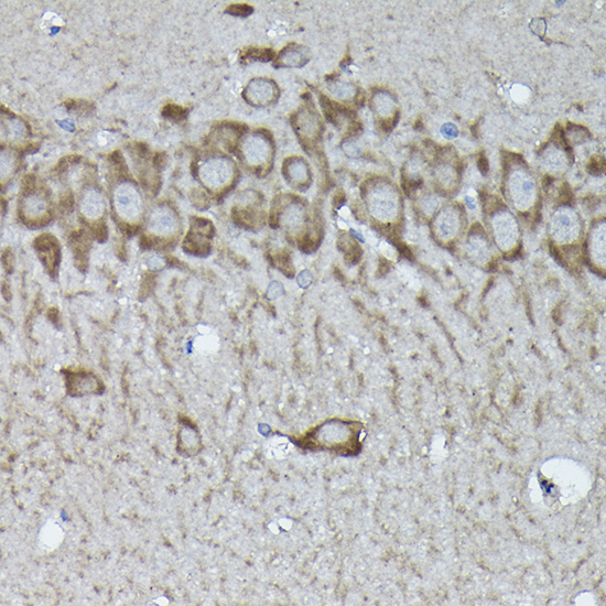 Calreticulin Rabbit Polyclonal Antibody - Image 7