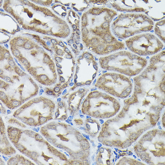 Calreticulin Rabbit Polyclonal Antibody - Image 8