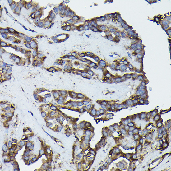 Calreticulin Rabbit Polyclonal Antibody - Image 9