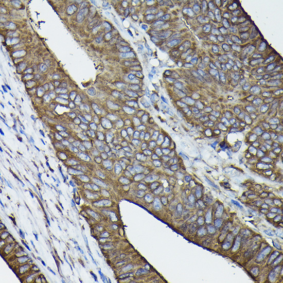 Calreticulin Rabbit Polyclonal Antibody - Image 10