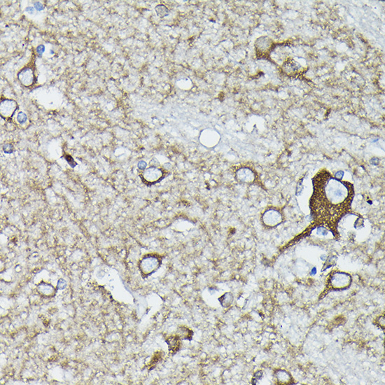 Calreticulin Rabbit Polyclonal Antibody - Image 11