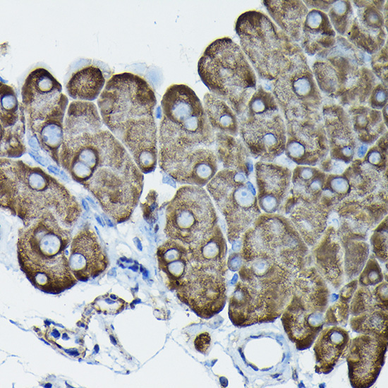 Calreticulin Rabbit Polyclonal Antibody - Image 12