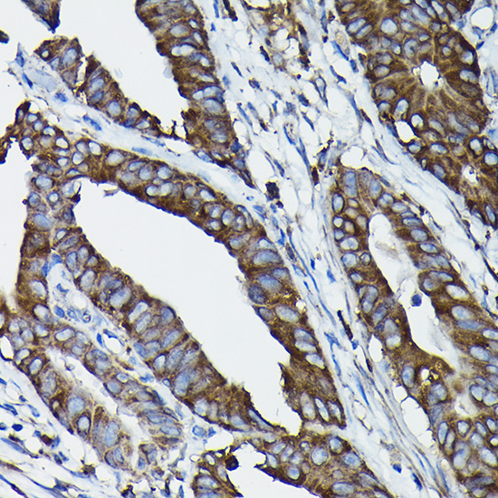 Calreticulin Rabbit Polyclonal Antibody - Image 13