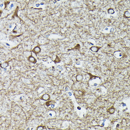 Calreticulin Rabbit Polyclonal Antibody - Image 14
