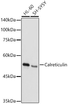 Calreticulin Rabbit Polyclonal Antibody