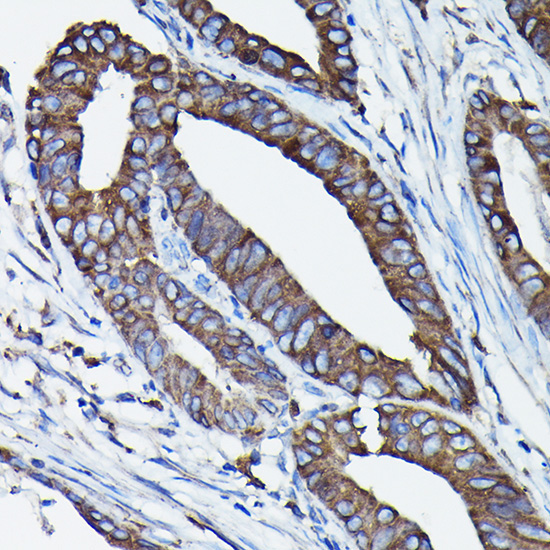 Calreticulin Rabbit Polyclonal Antibody - Image 2