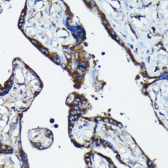 Calreticulin Rabbit Polyclonal Antibody - Image 3