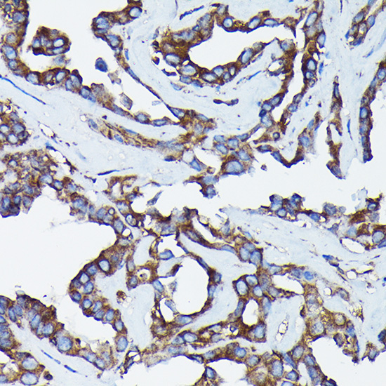 Calreticulin Rabbit Polyclonal Antibody - Image 4