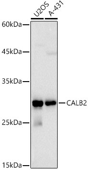 Calretinin Rabbit Polyclonal Antibody - Image 2