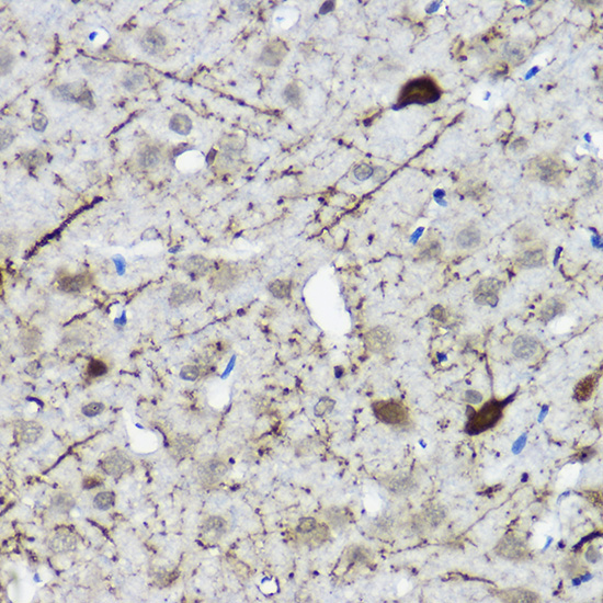 Calretinin Rabbit Polyclonal Antibody - Image 3