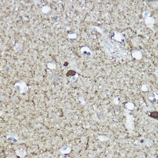 Calretinin Rabbit Polyclonal Antibody - Image 4