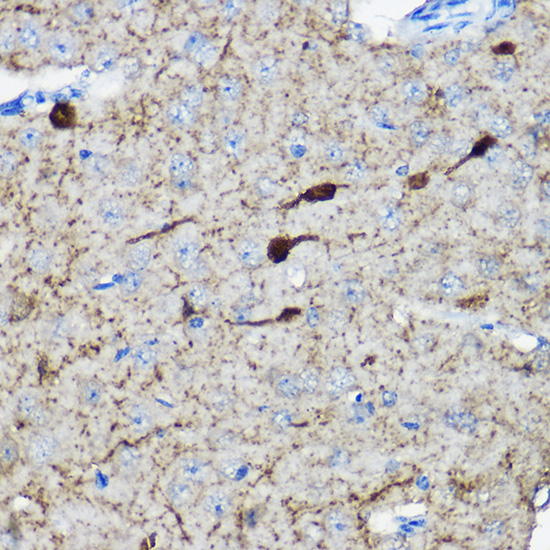 Calretinin Rabbit Polyclonal Antibody - Image 5
