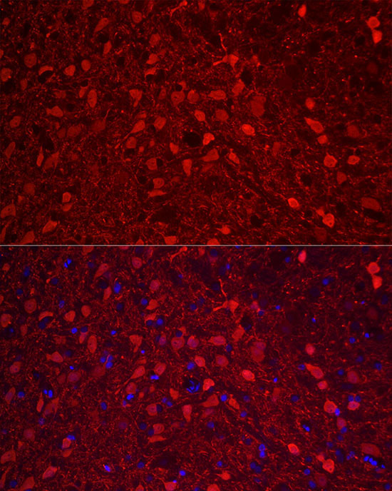Calretinin Rabbit Polyclonal Antibody - Image 6
