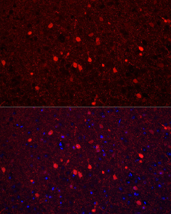 Calretinin Rabbit Polyclonal Antibody - Image 7
