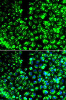 CALU Rabbit Polyclonal Antibody