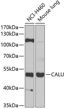 CALU Rabbit Polyclonal Antibody